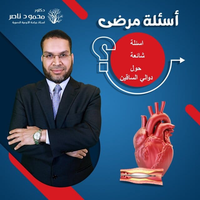 اسئلة حول دوالي الساقين